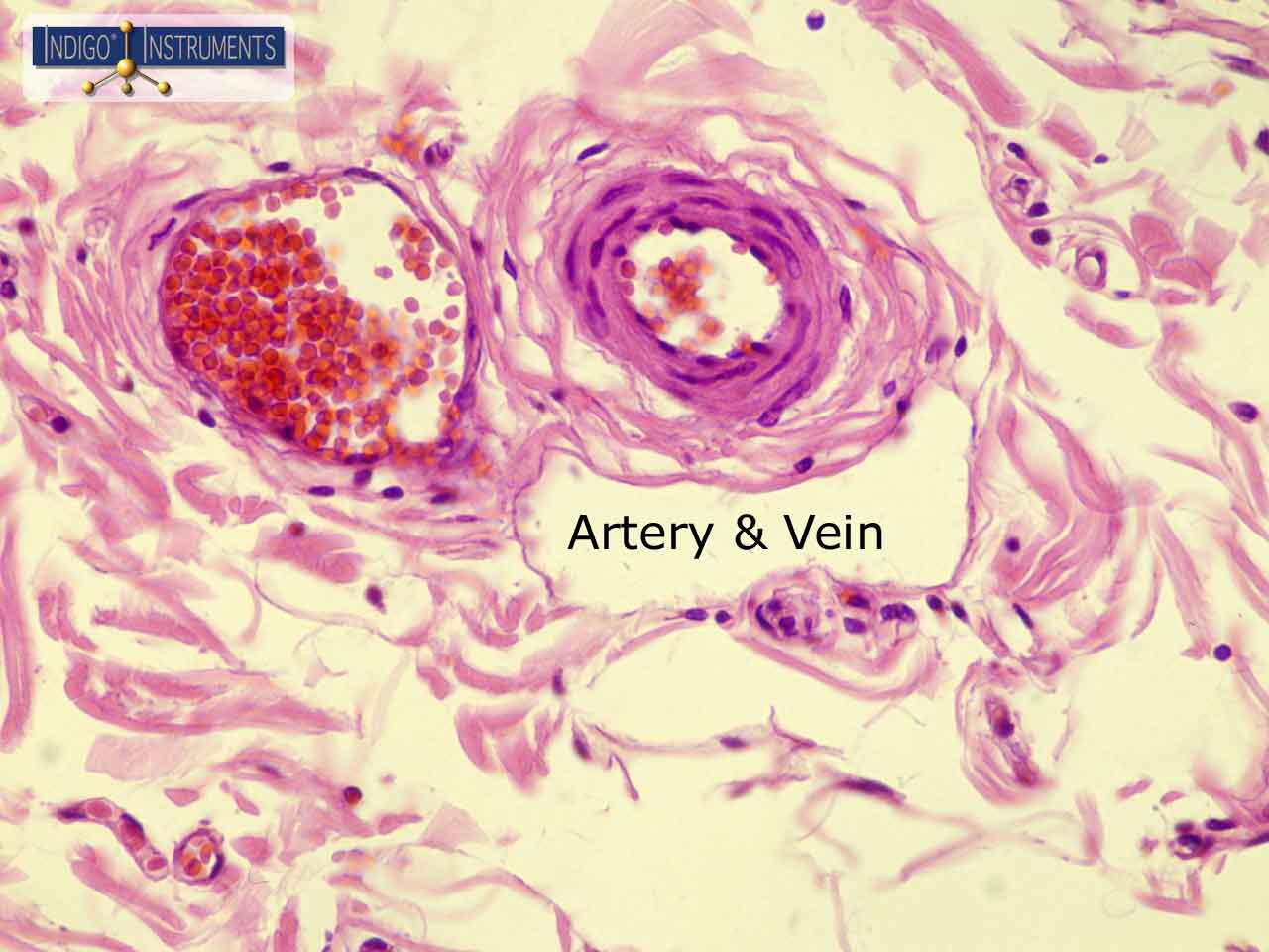 Artery Vein Histology Section