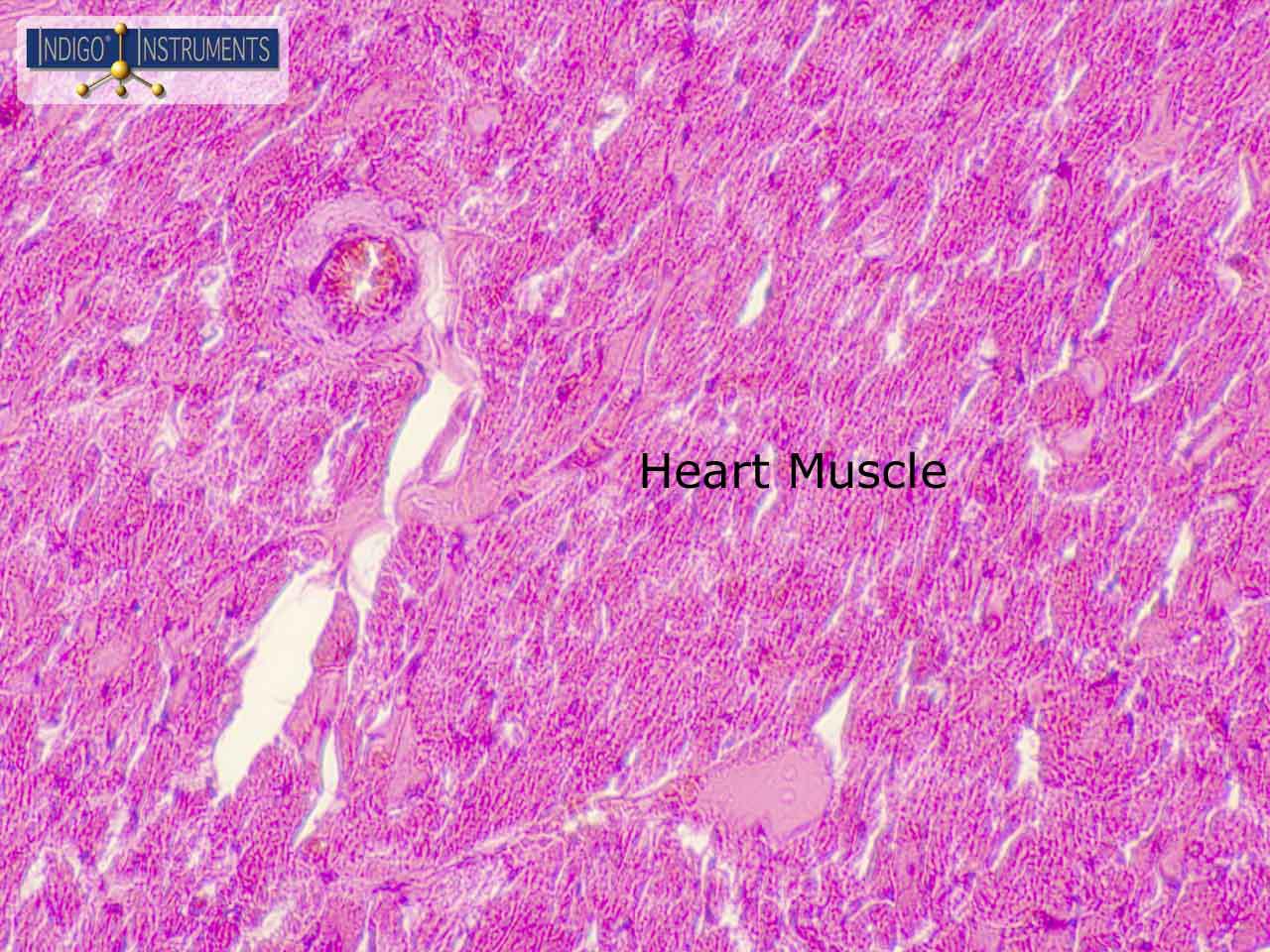 Heart Muscle
